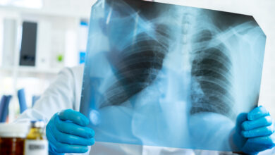 Cáncer de pulmón